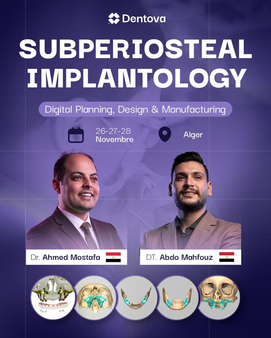 Implants sous-périostés personnalisés par patient